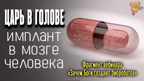 ЦАРЬ в голове &ndash; имплант в мозг человека